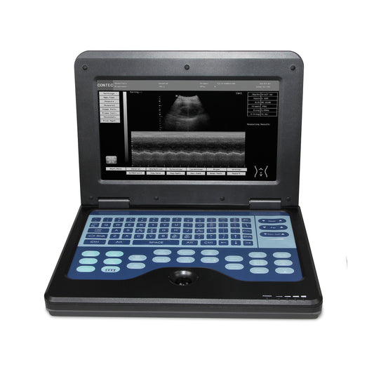 Tragbare Ultraschall-Scanner Laptop Digital-Diagnose-Maschine 3.5 konvexe Sonde