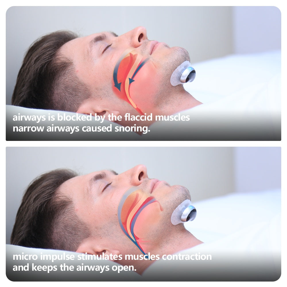 Smart Anti Snoring Device